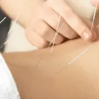 鍼灸
